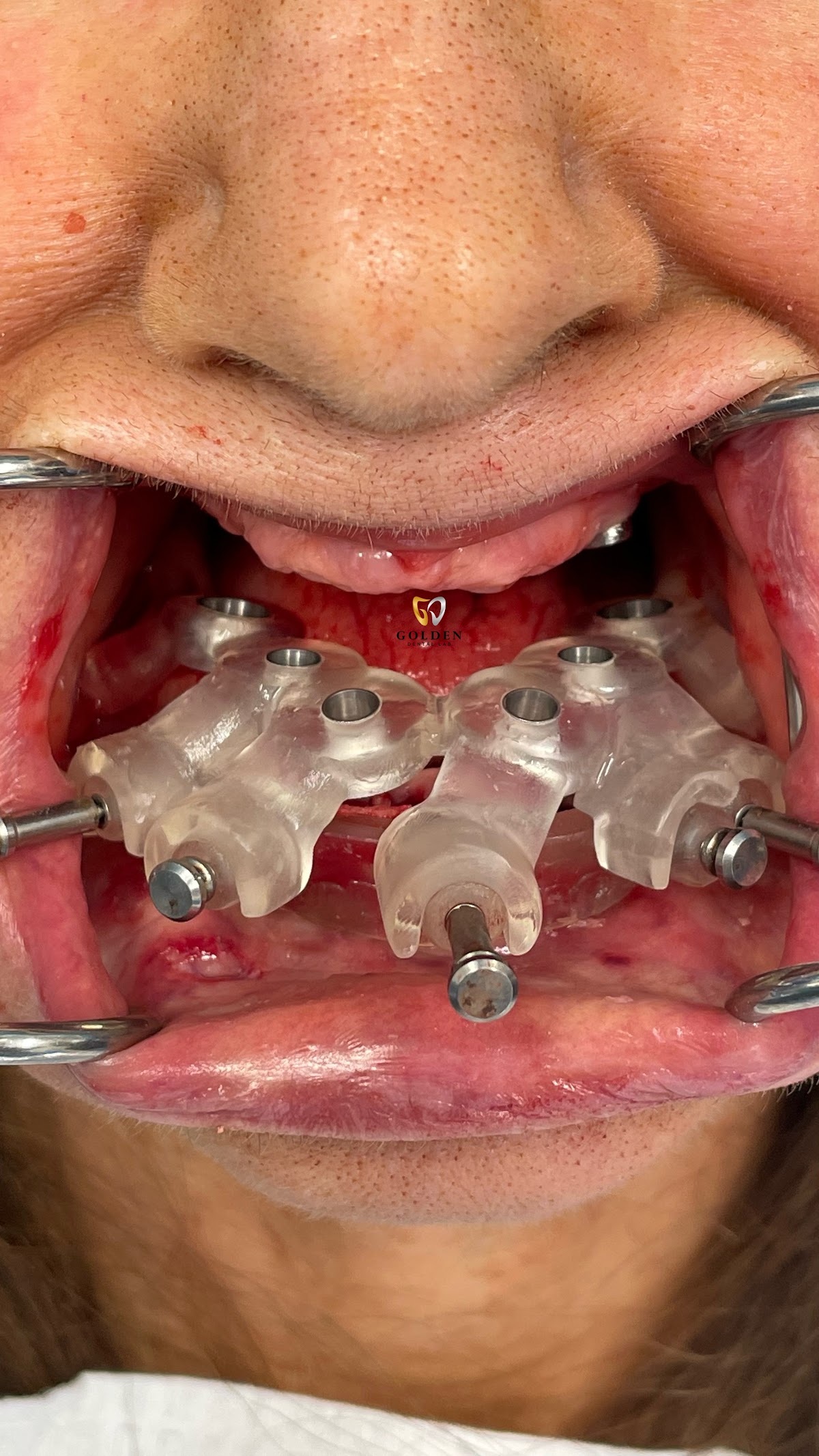 Golden Dental Lab photo 3