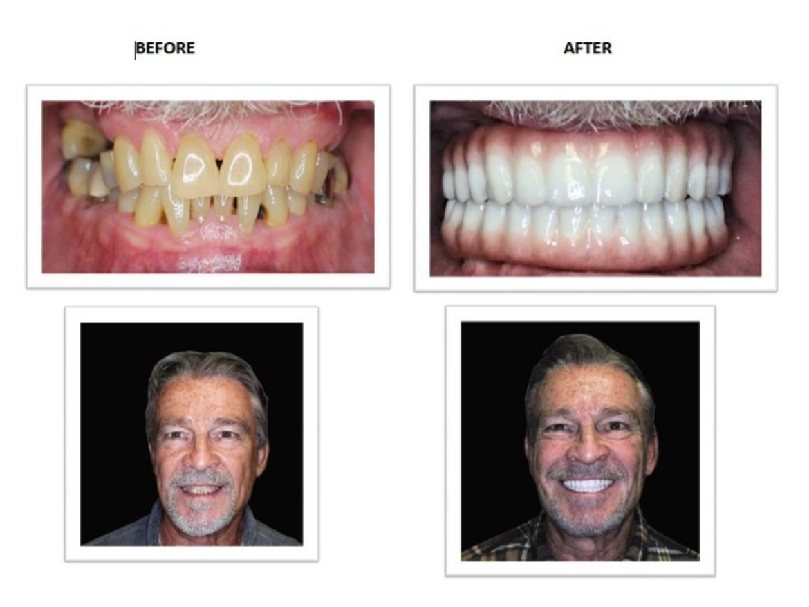 Implants4life photo 6