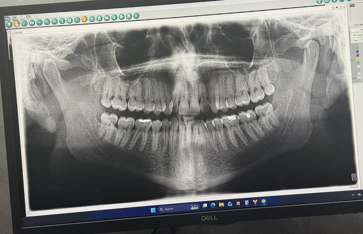 Aspen Dental - Phoenix photo 3