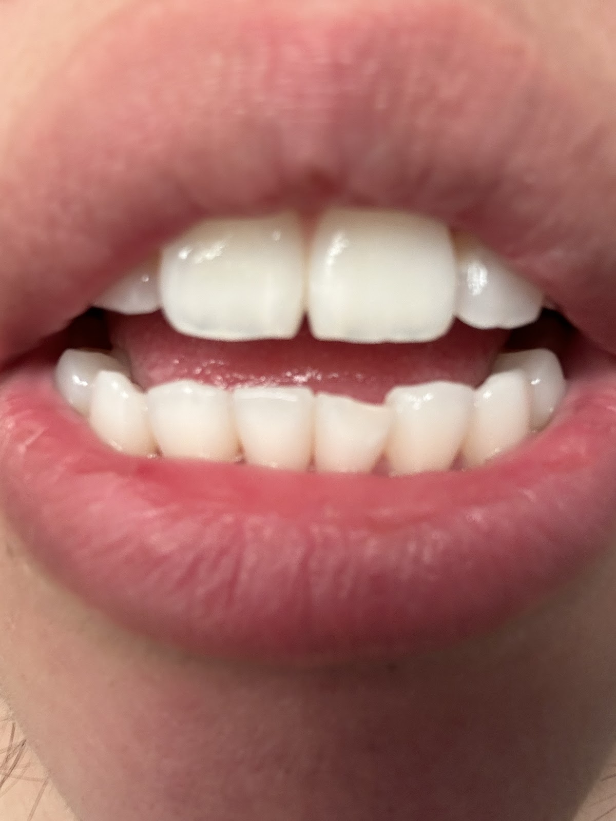 Aspen Dental - Phoenix photo 5