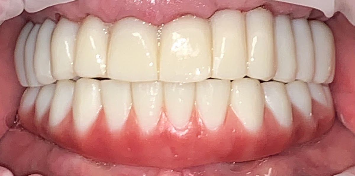 Dental Implant Docs photo 1