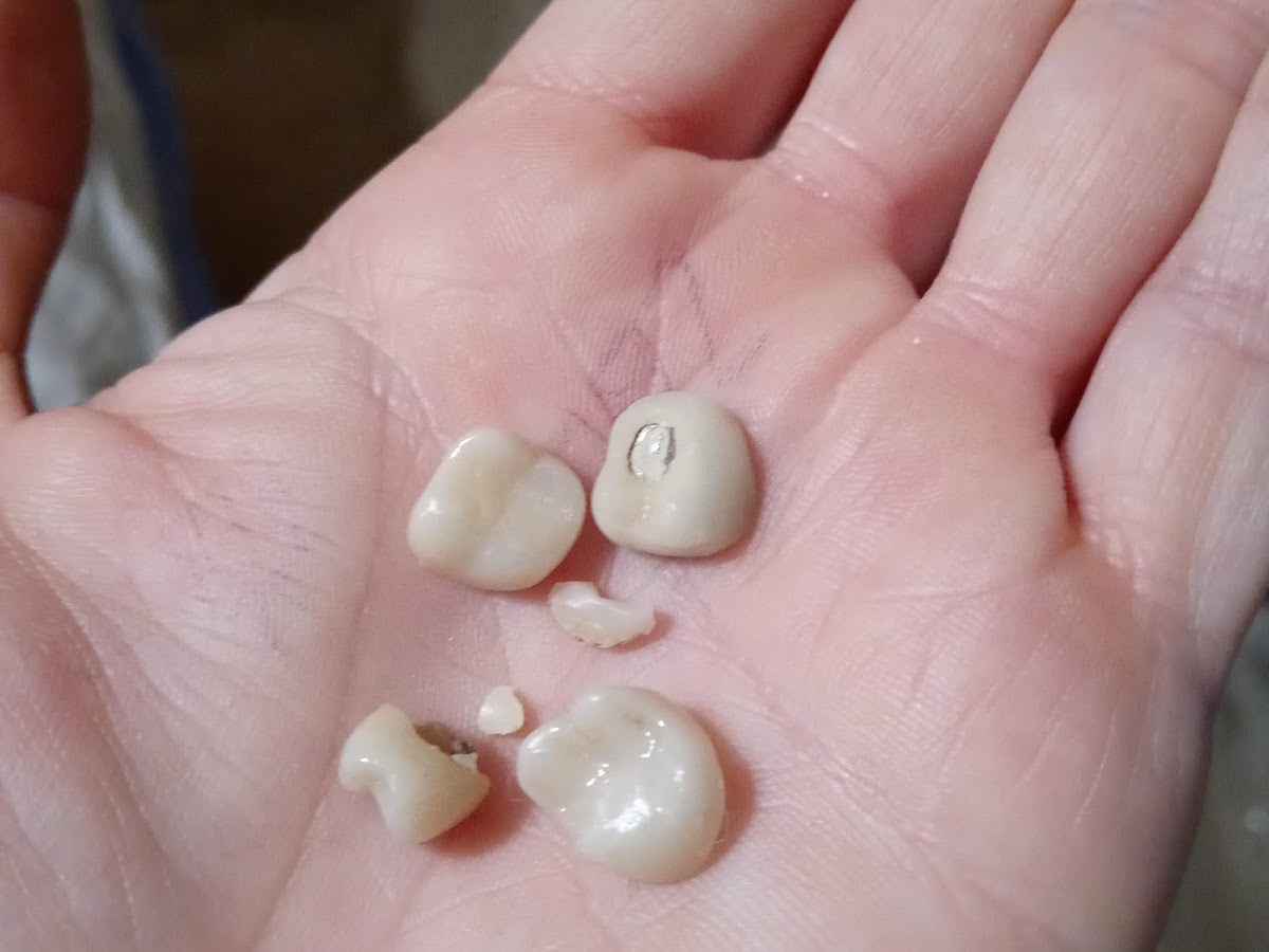 Aspen Dental - Flint photo 1