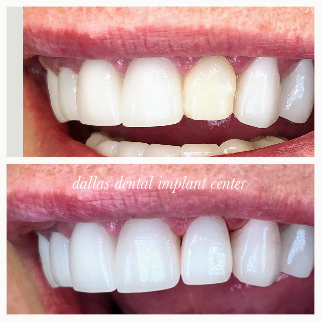 Dallas Dental Implant Center photo 2