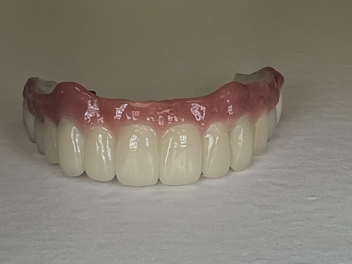 Dallas Dental Implant Center photo 3