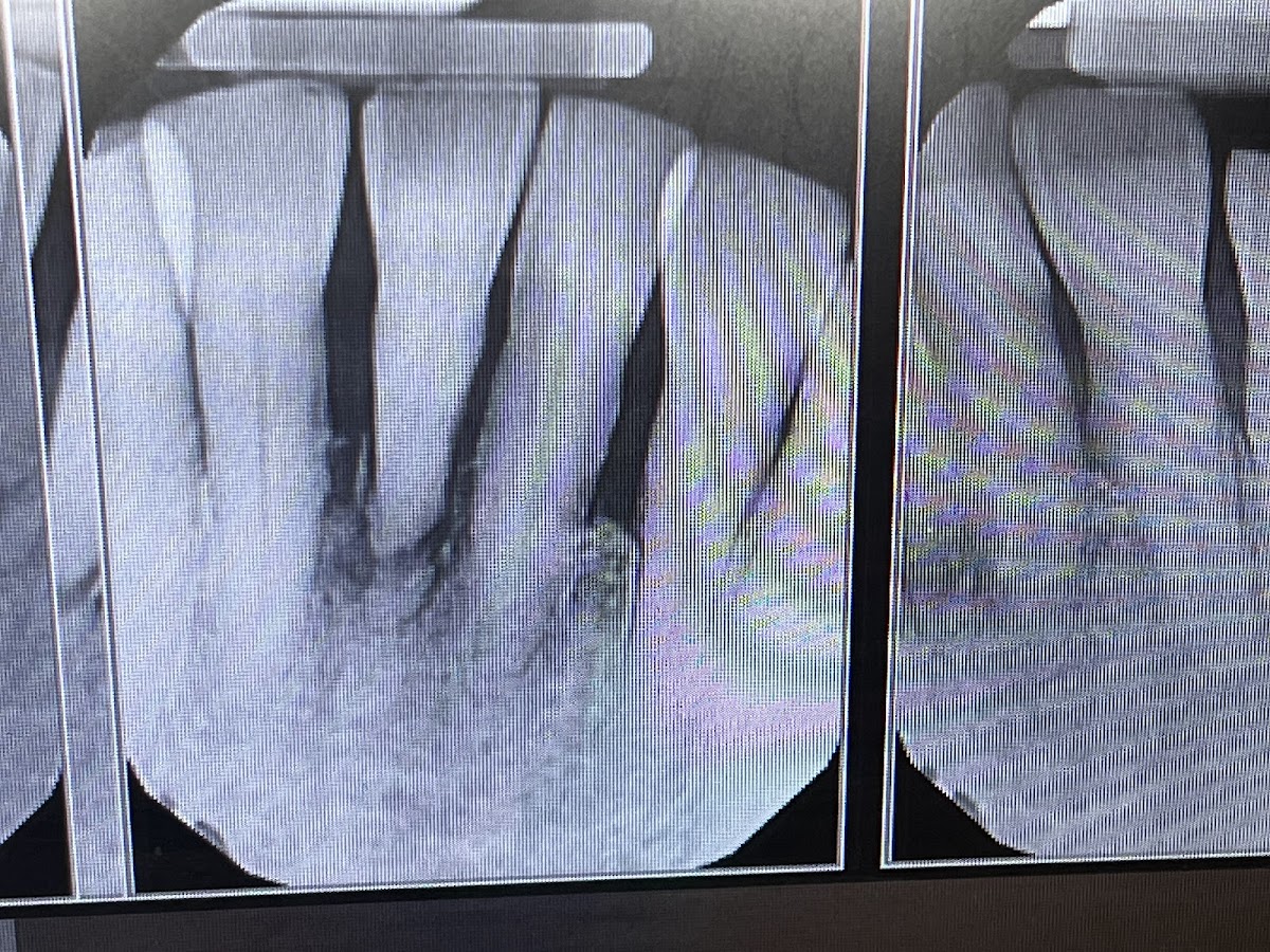 Dallas Dental Implant Center photo 5