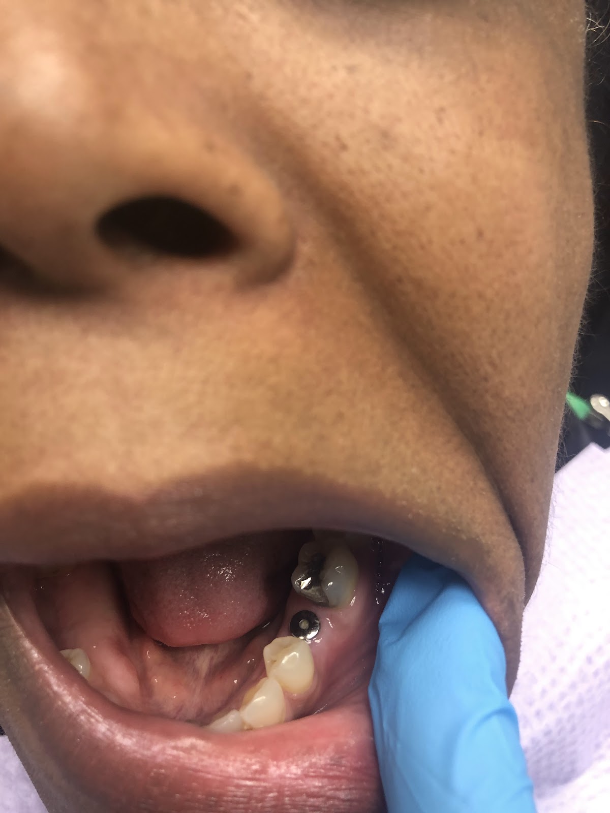 Dallas Dental Implant Center photo 6