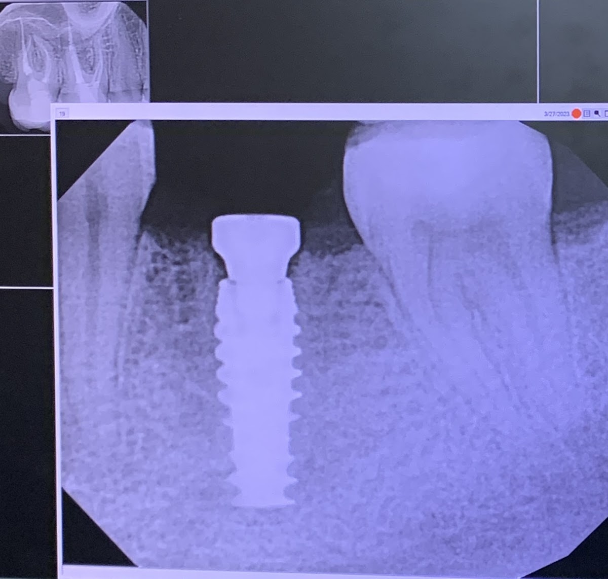 Triangle Periodontics photo 3