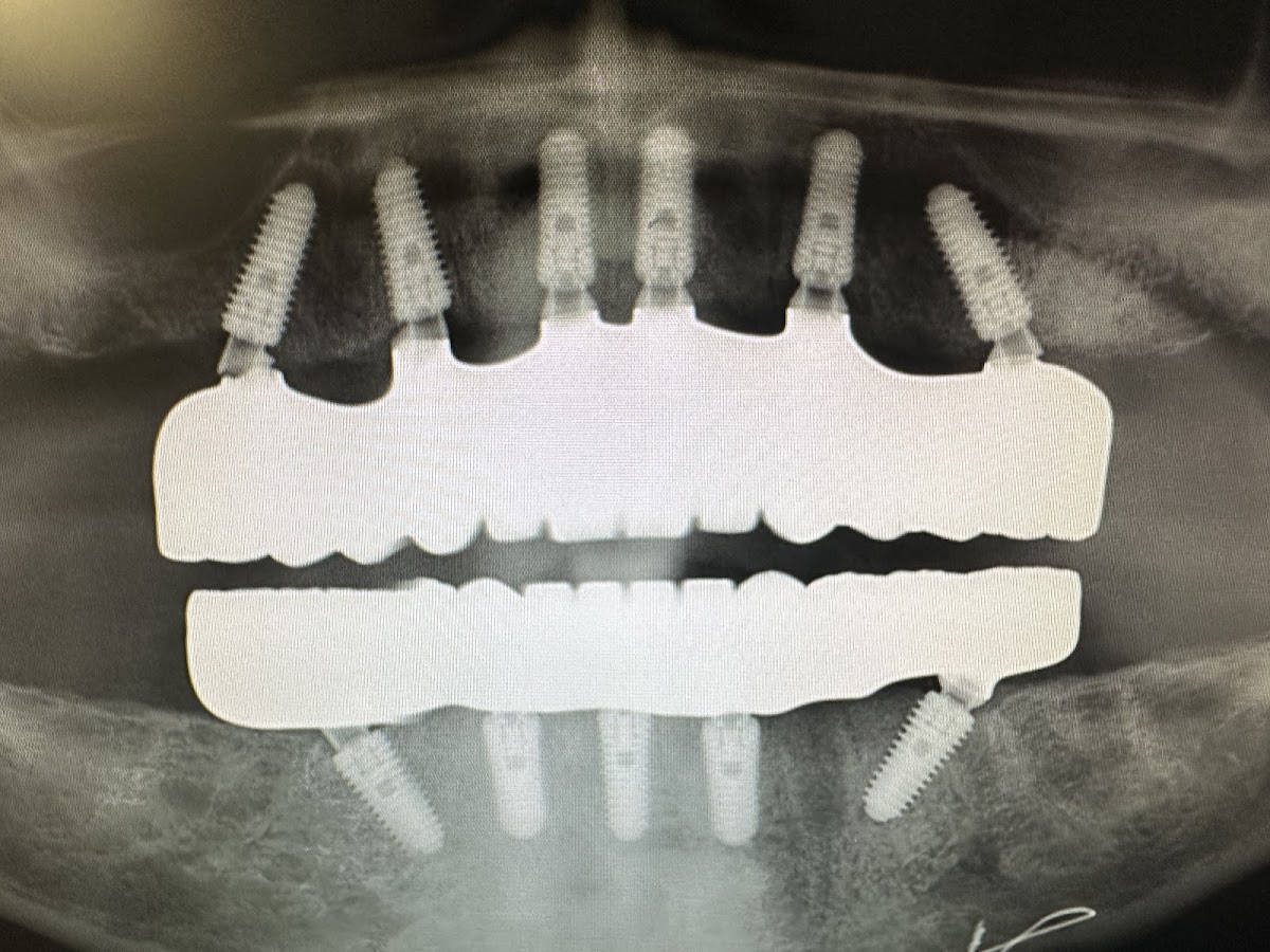 North Coast Dental Implants & Cosmetics photo 6