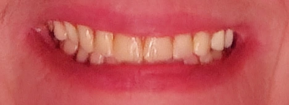 Aspen Dental - Columbia photo 5