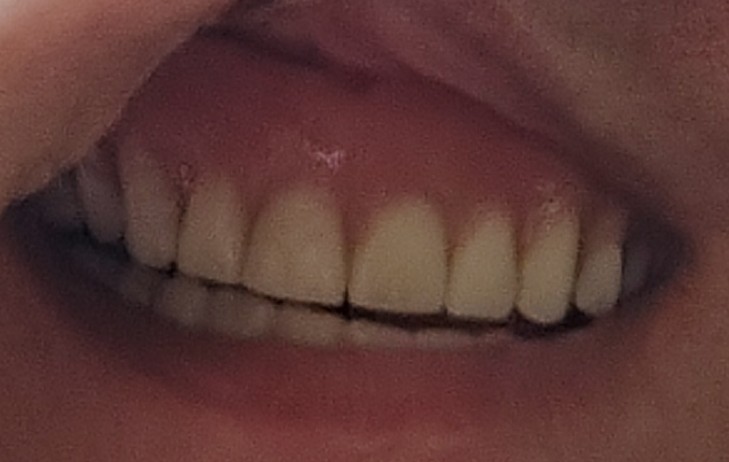 Aspen Dental - Columbia photo 6