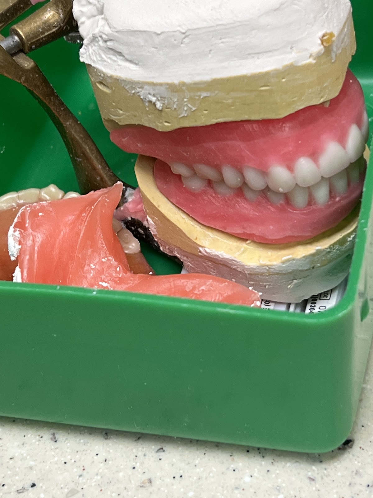 Affordable Dentures & Implants - Merrillville photo 2