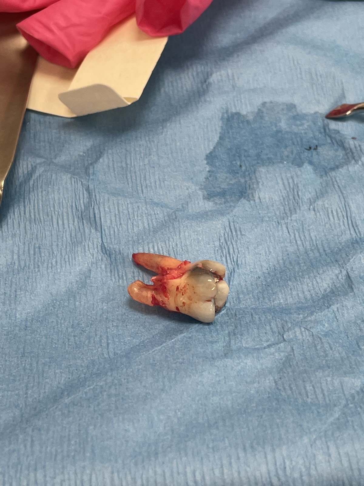Ohio Dental Implants & Oral Surgery photo 2
