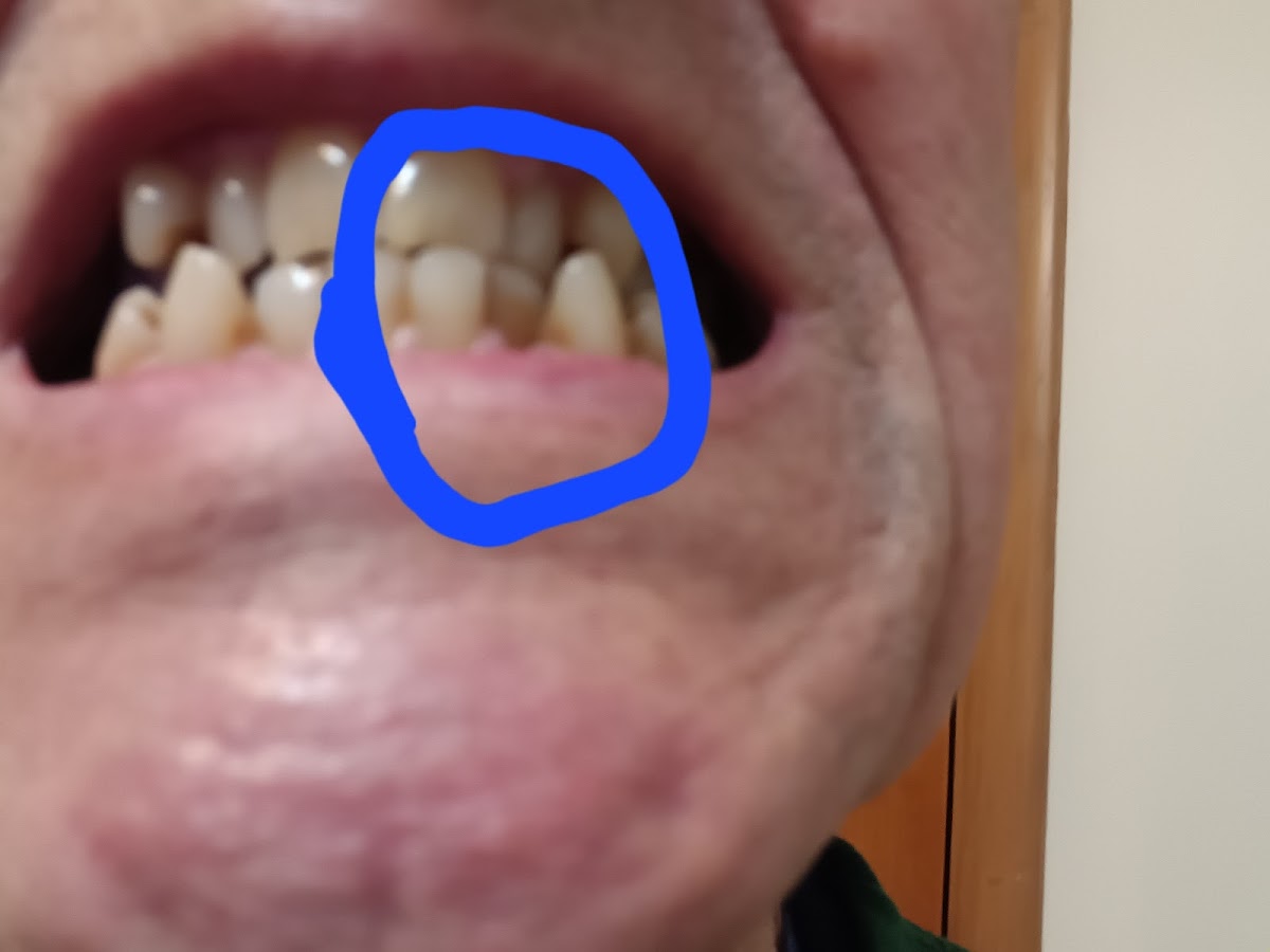 Ohio Dental Implants & Oral Surgery photo 3