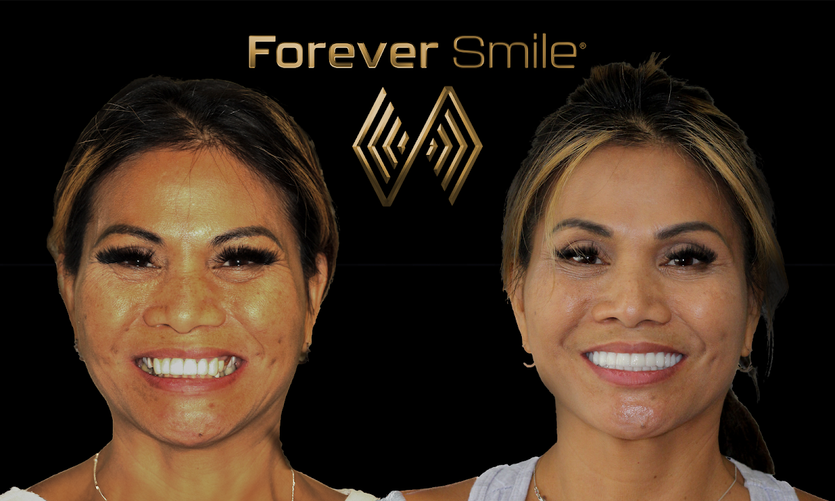 The Forever Smile photo 2