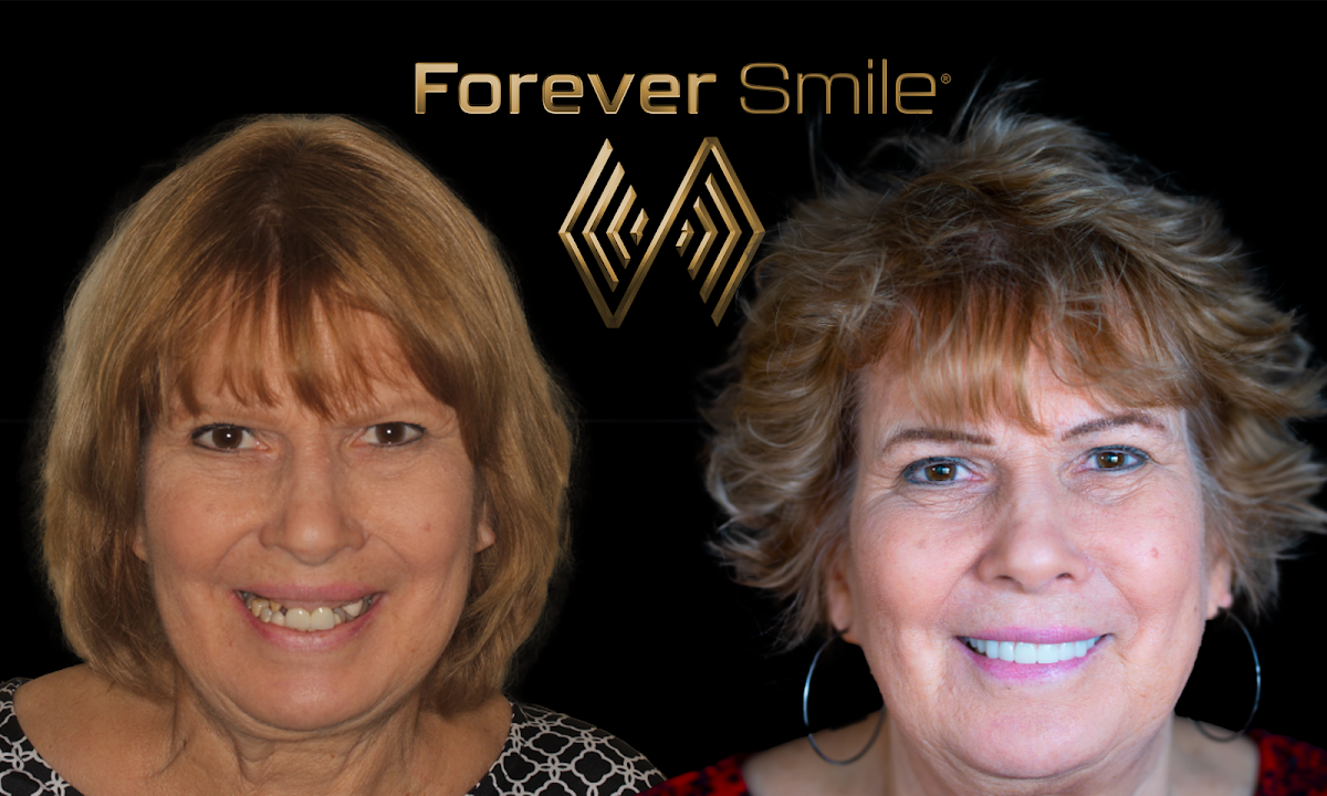 The Forever Smile photo 4