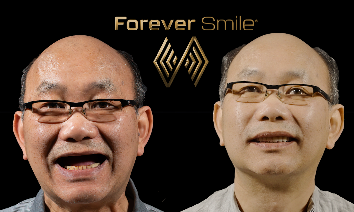 The Forever Smile photo 5