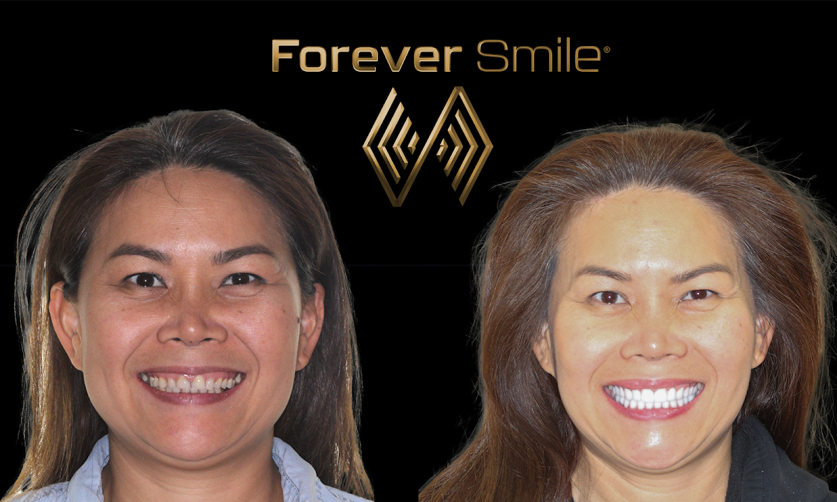 The Forever Smile photo 6
