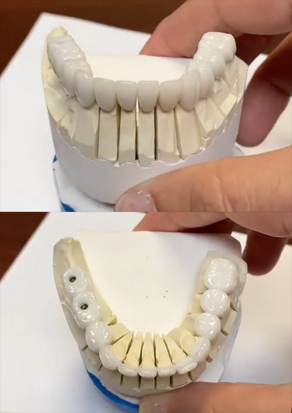 4m Dental Implant Center - Sacramento photo 2