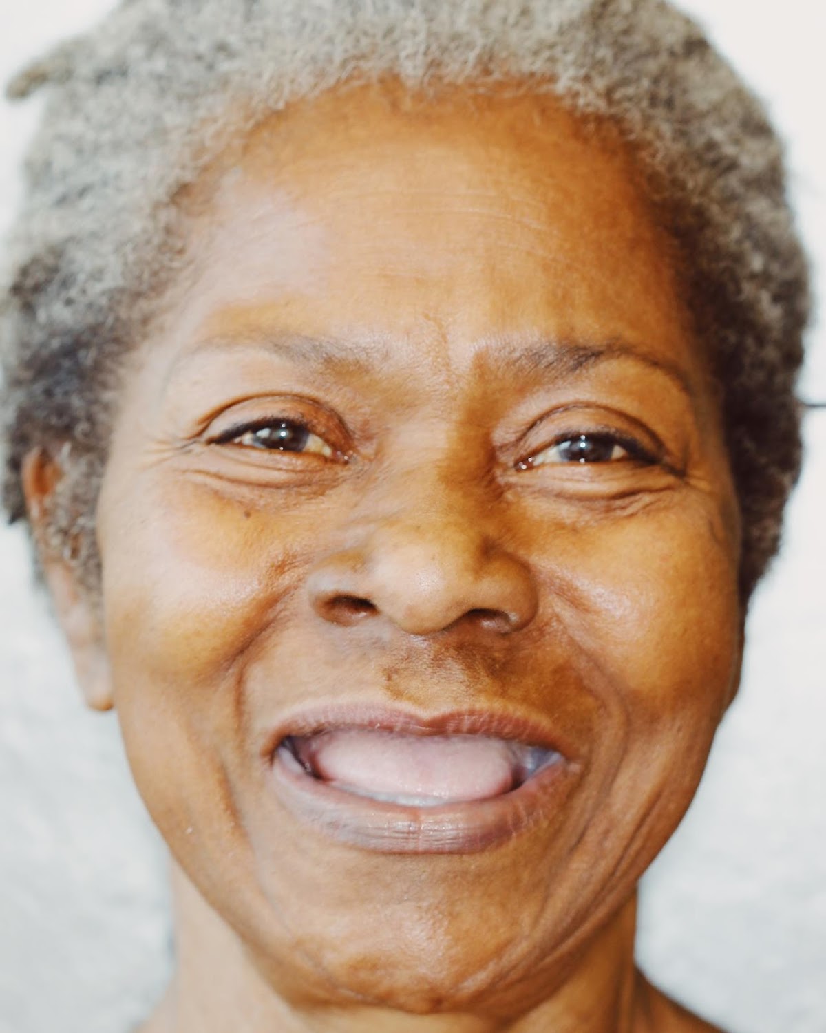 4m Dental Implant Center - Sacramento photo 6