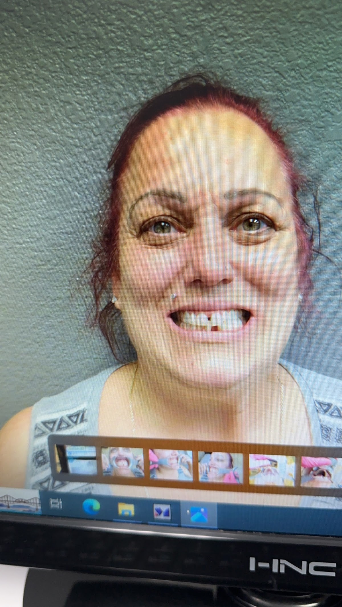 Affordable Dental at Laughlin photo 5