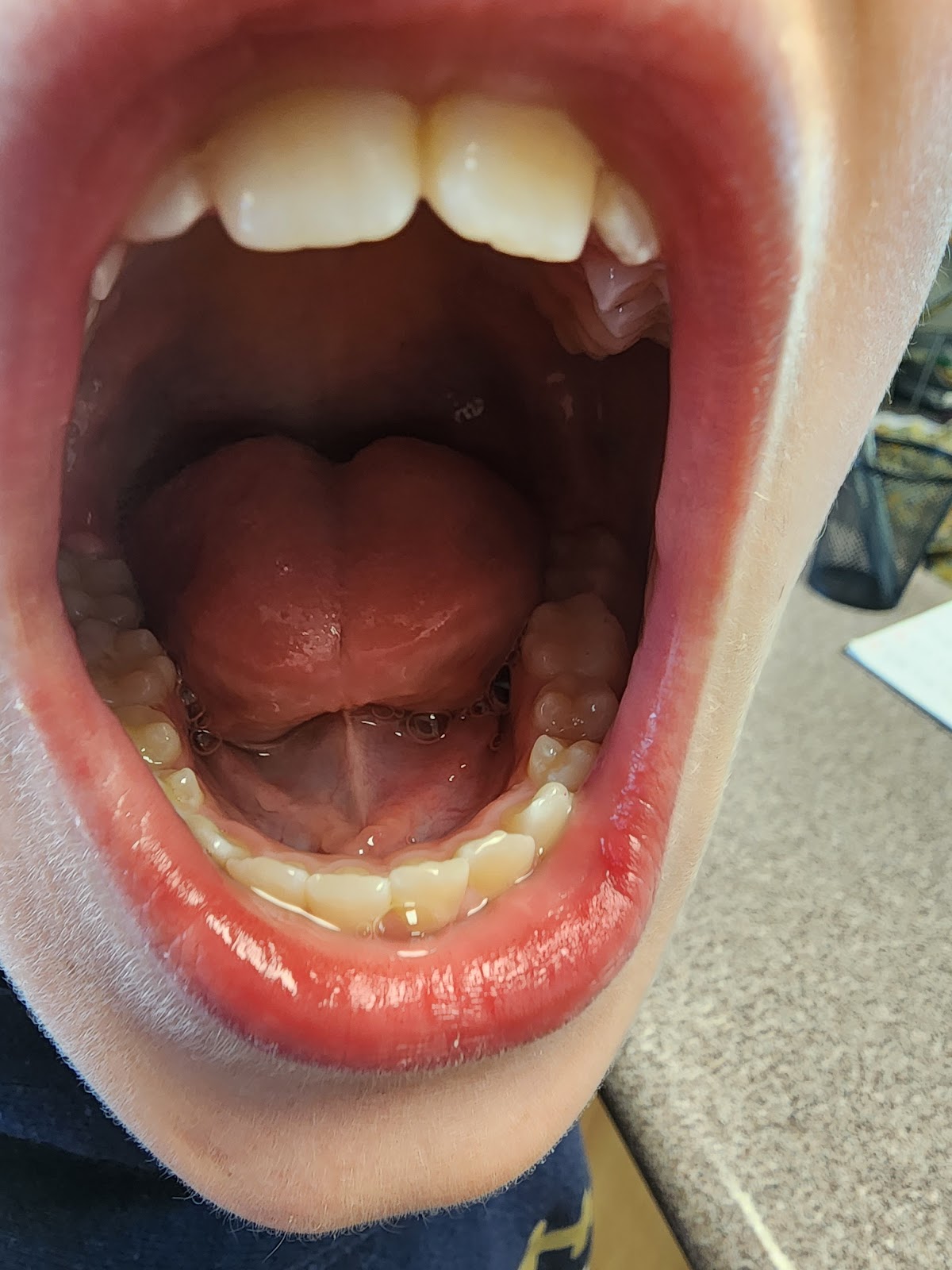 Dentistry at Marysville - Implant, Cosmetic, and Family Dentistry photo 2