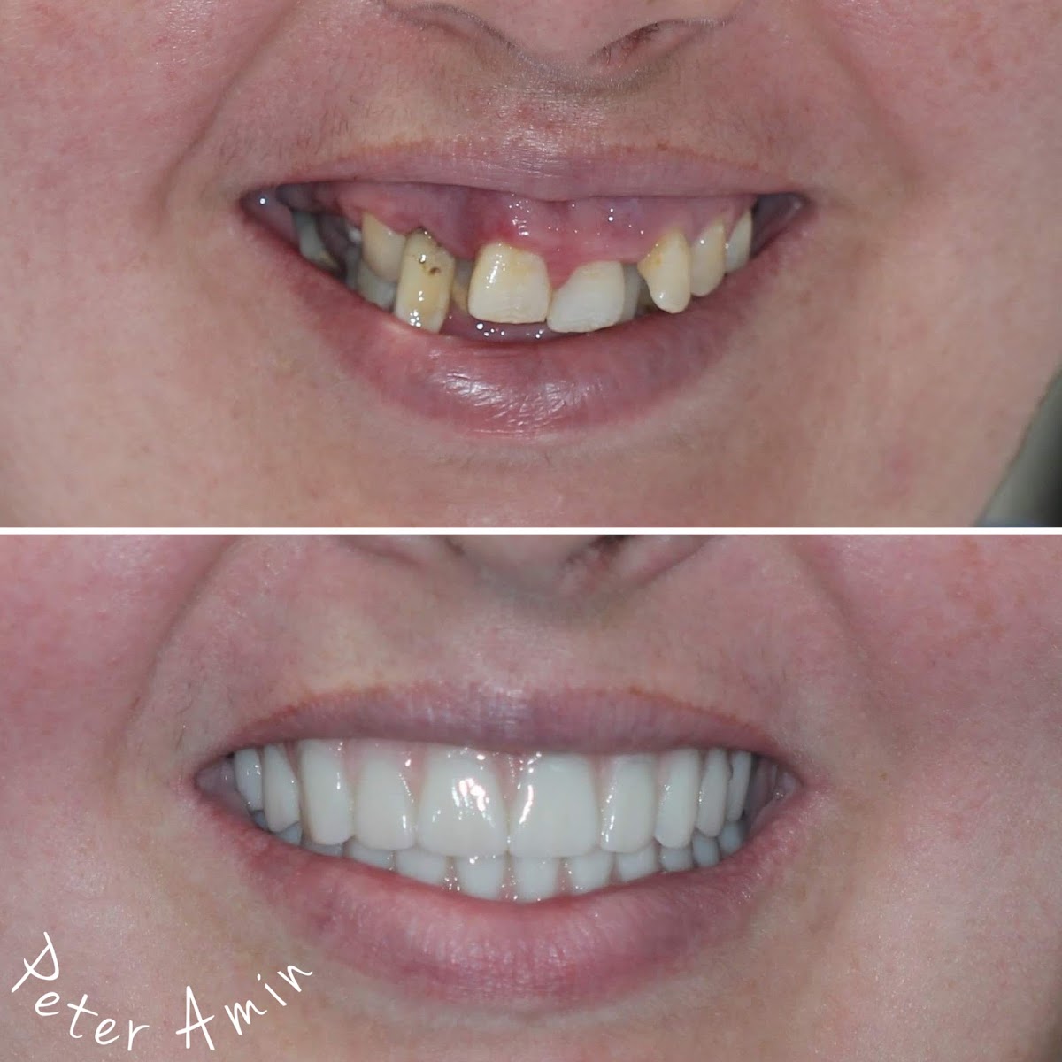 Cleveland Dental Implant Center photo 6