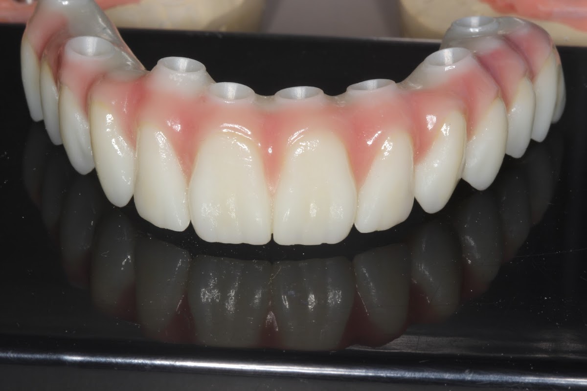 Dental Implant Solutions of Idaho photo 1