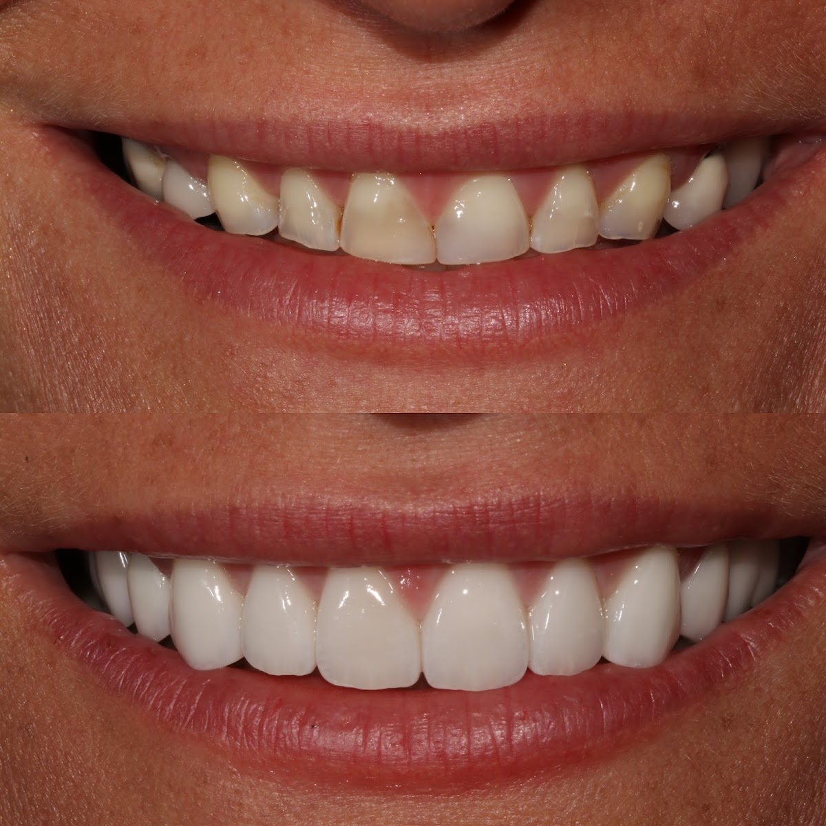 Dental Implant Solutions of Idaho photo 4