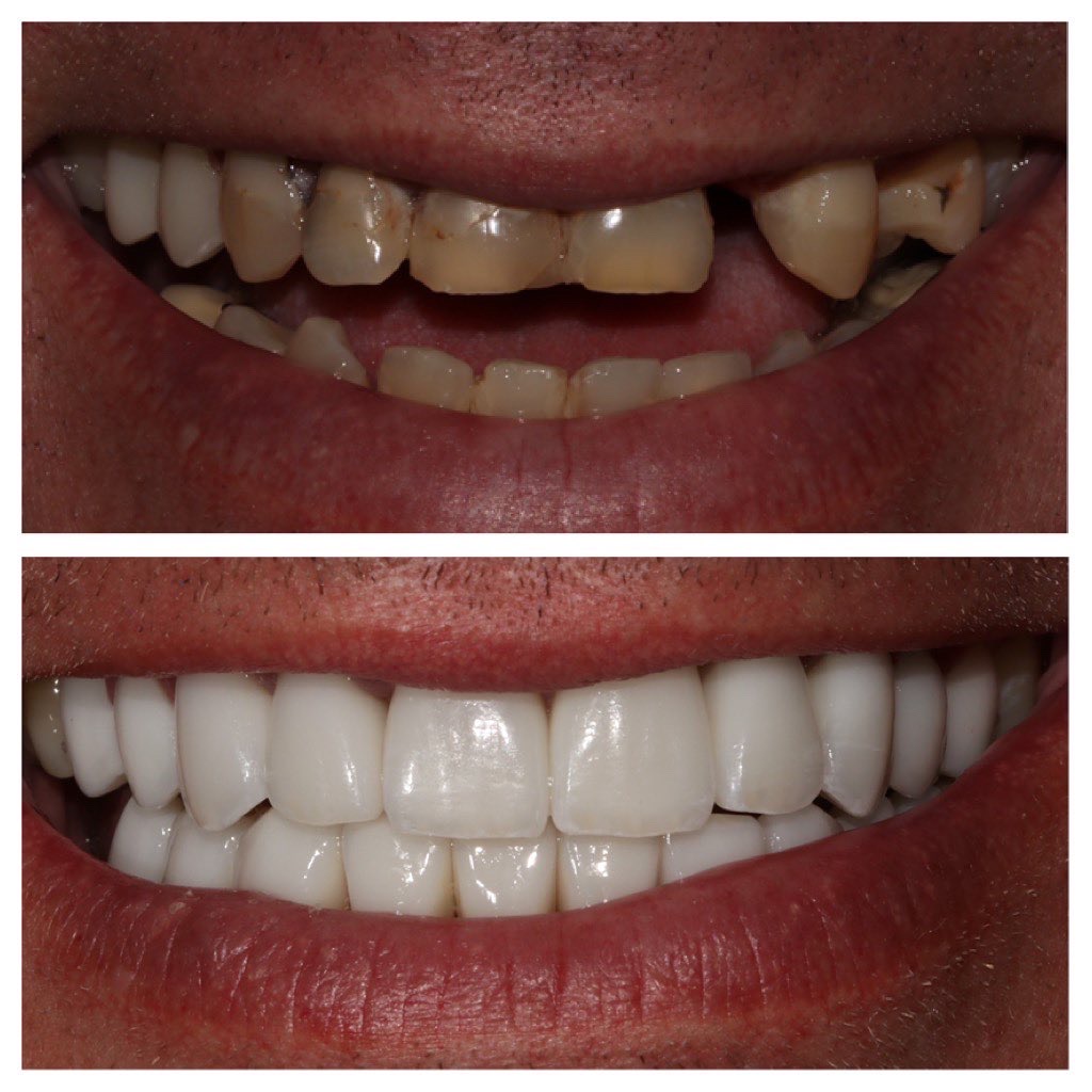 Dental Implant Solutions of Idaho photo 5