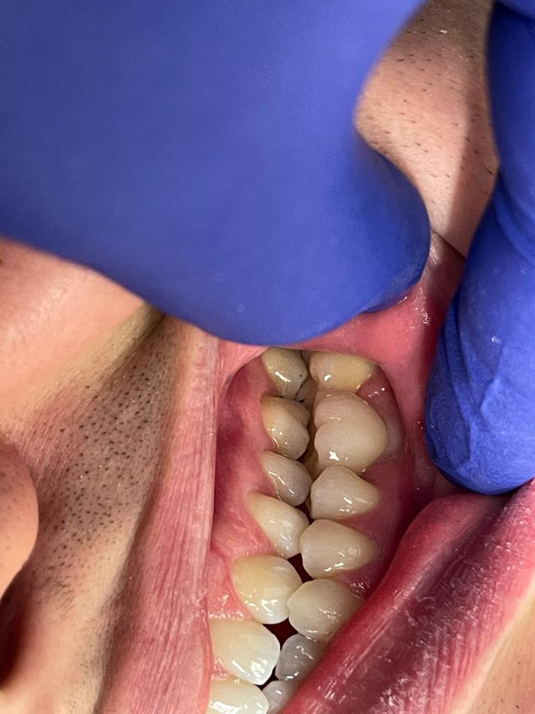 Dental Implants Cambridge photo 2