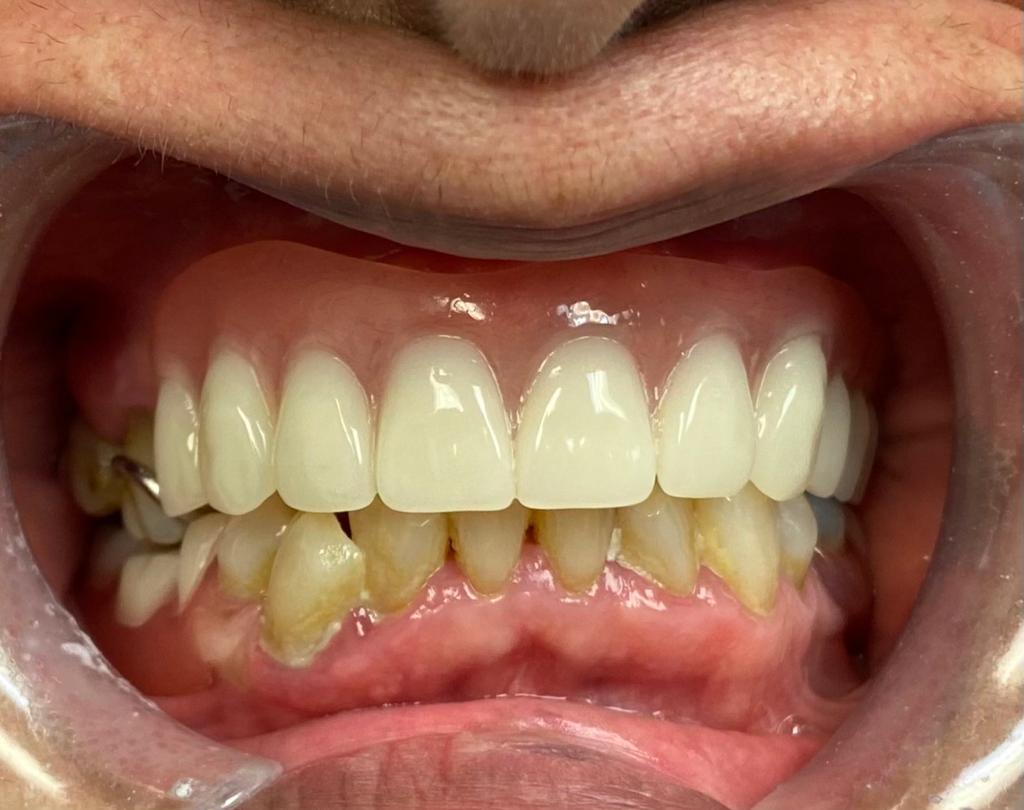 Dental Implants Cambridge photo 3