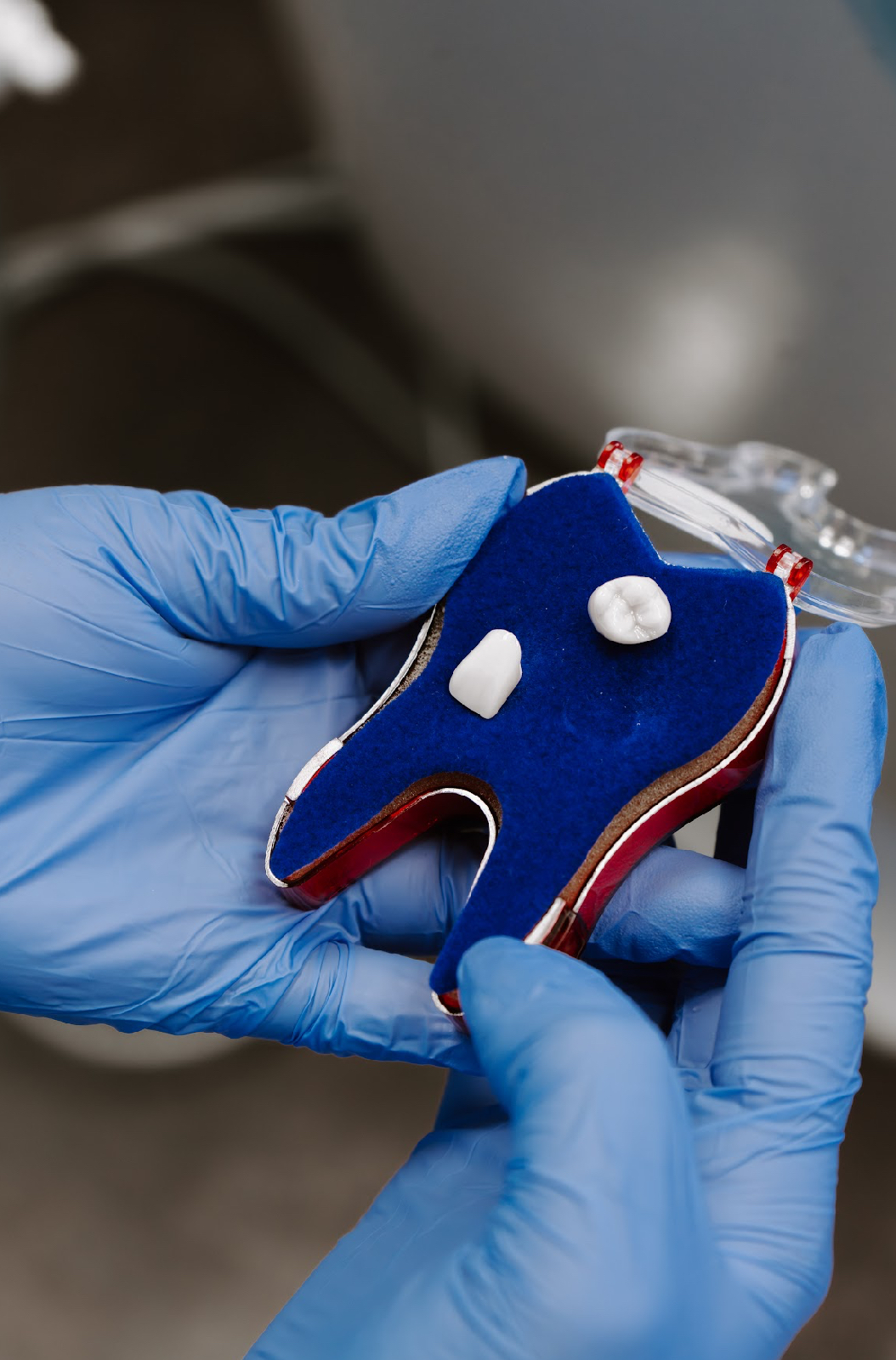 Dental Implants Cambridge photo 5