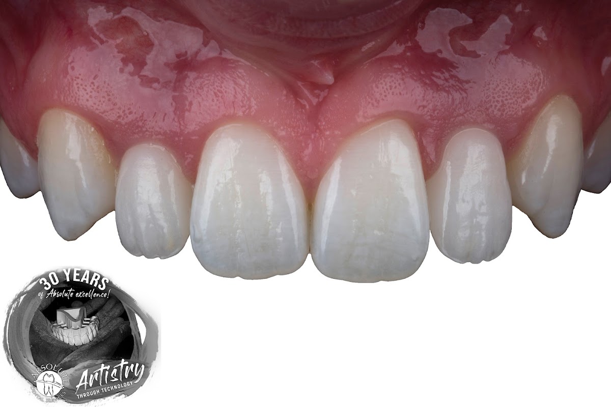 Absolute Dental Services photo 1