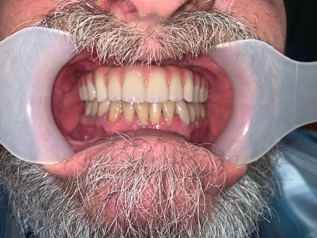 Absolute Dental Services photo 5