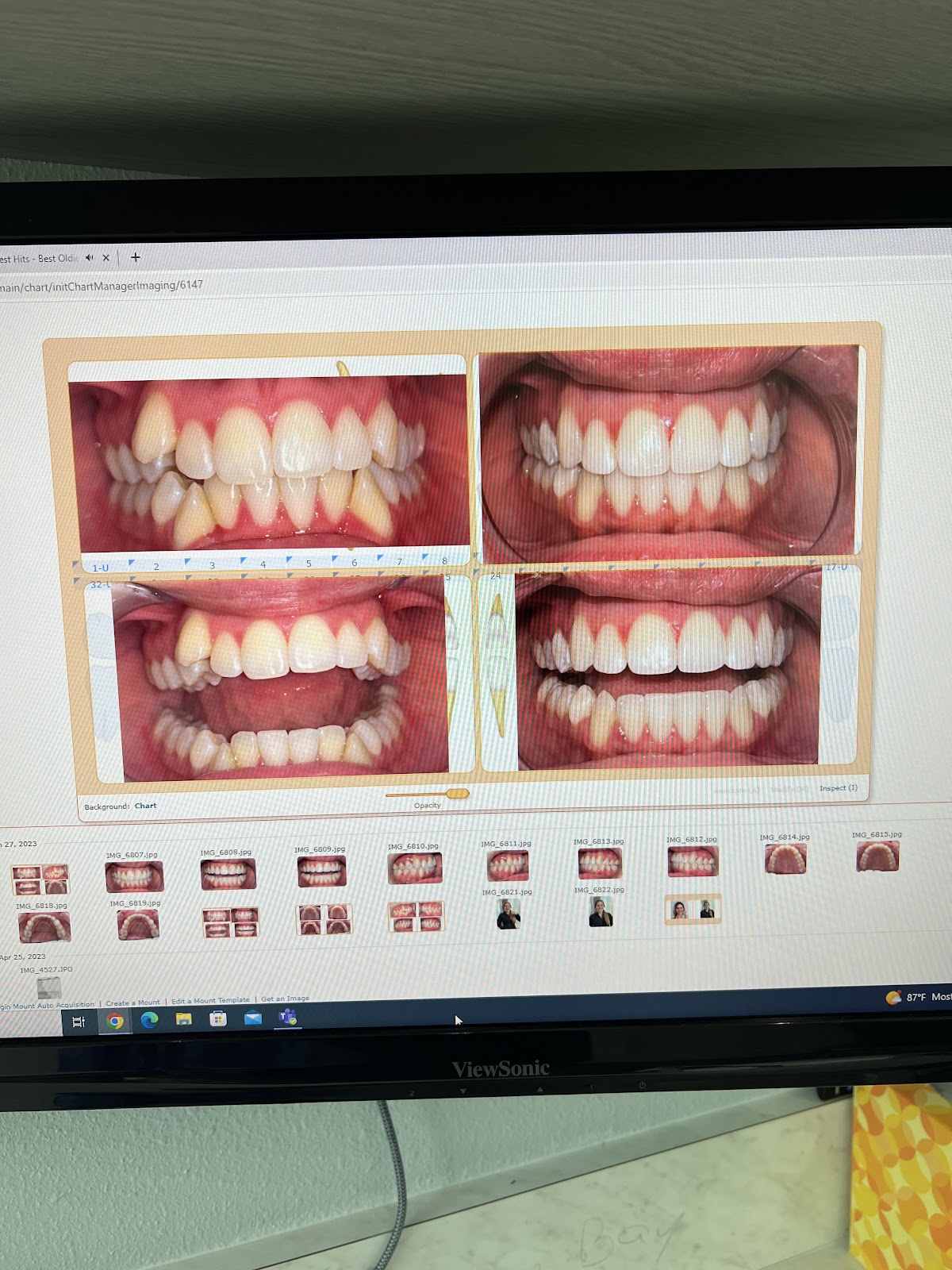 Watts Dental photo 5