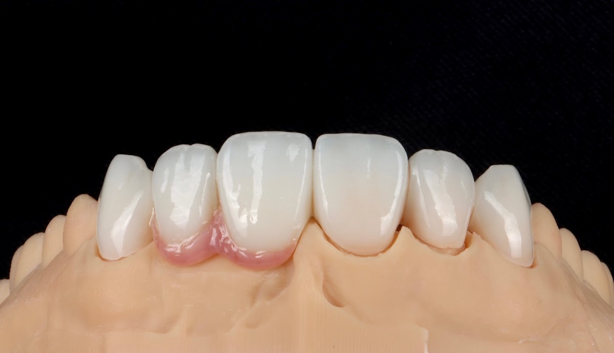 Jj Dental photo 4