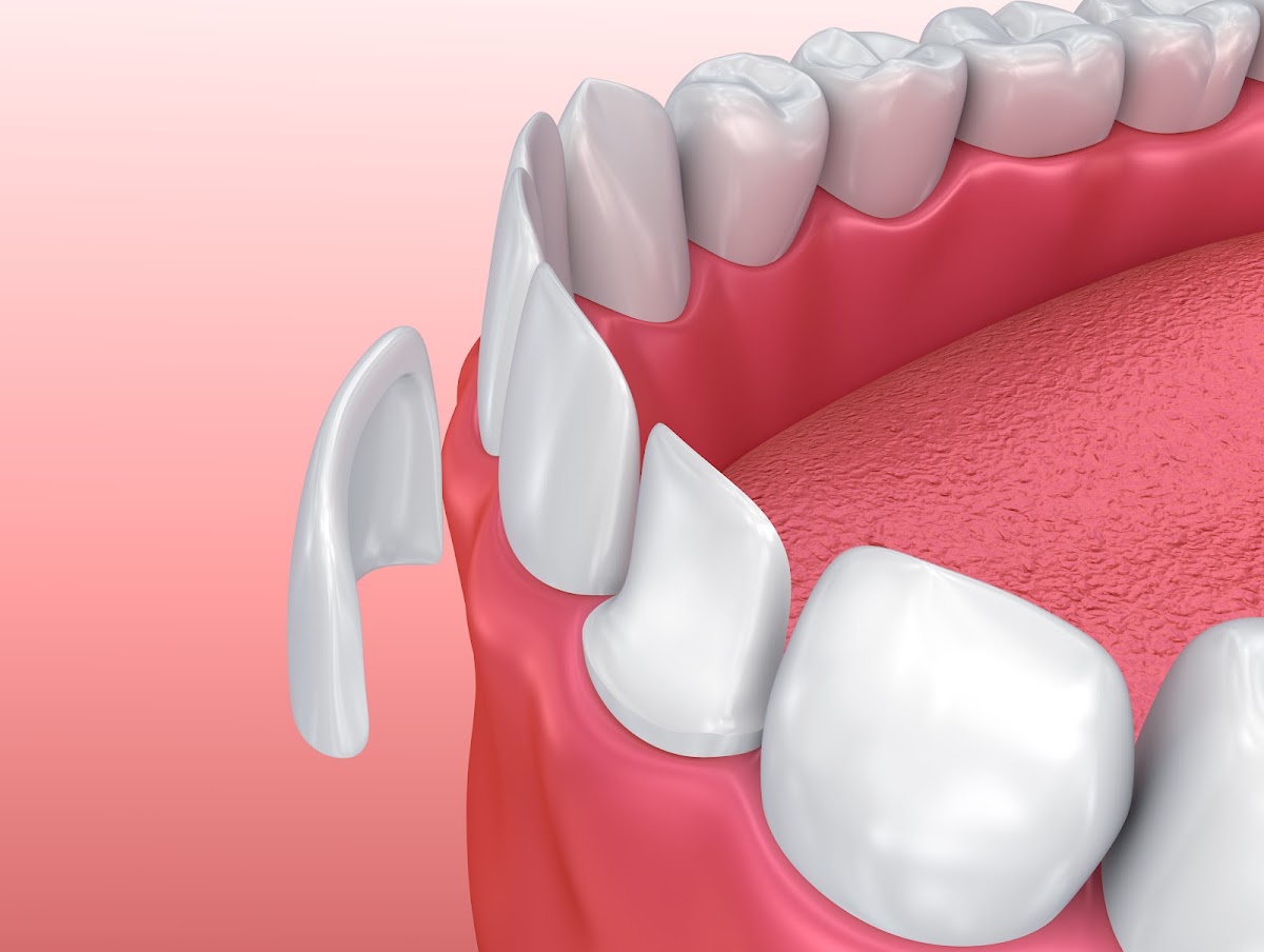 Perfect Smile and Implant Center | Dental Clinic photo 4