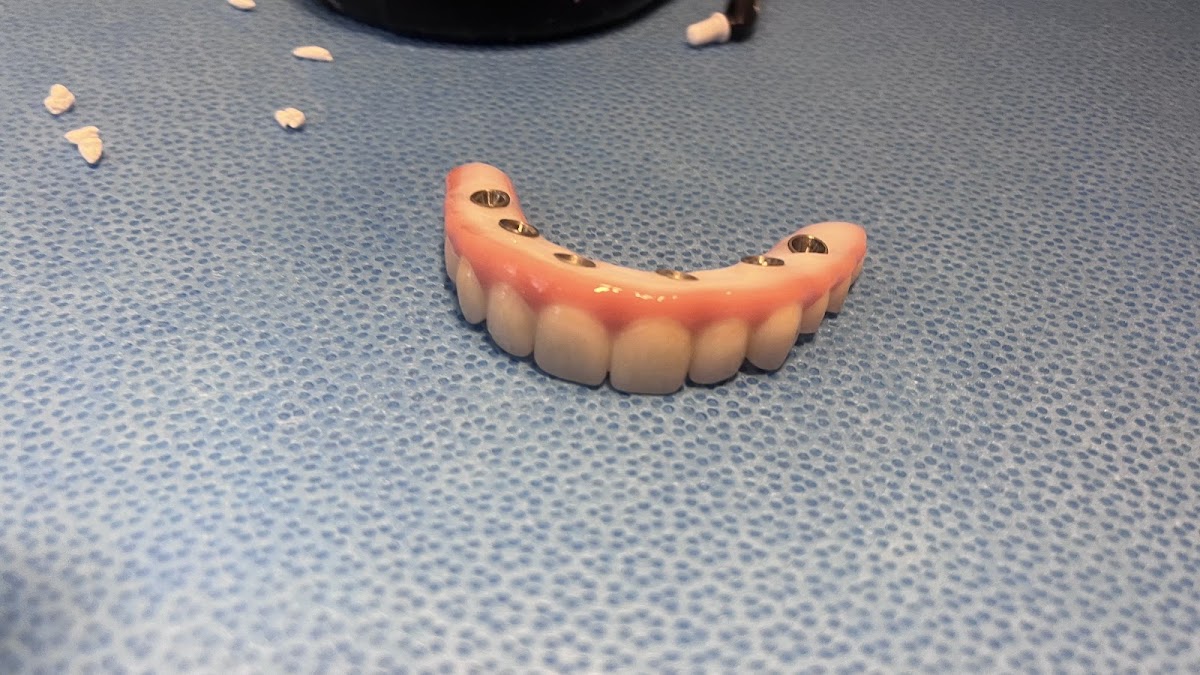Affordable Dentures & Implants photo 3
