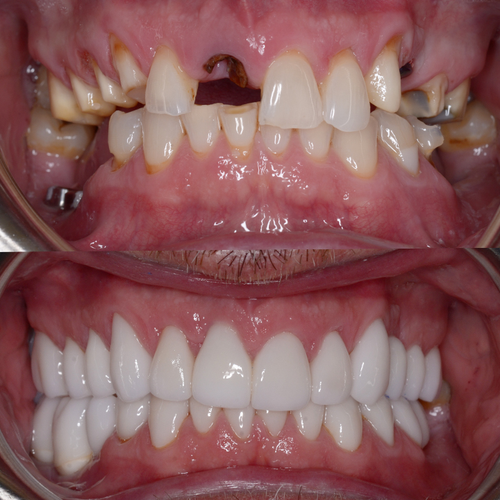 Boulder Canyon Dental photo 1