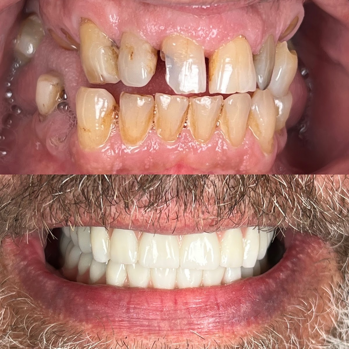 Signature Smiles Family & Implant Dentistry photo 2