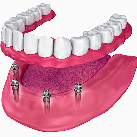Signature Smiles Family & Implant Dentistry photo 4