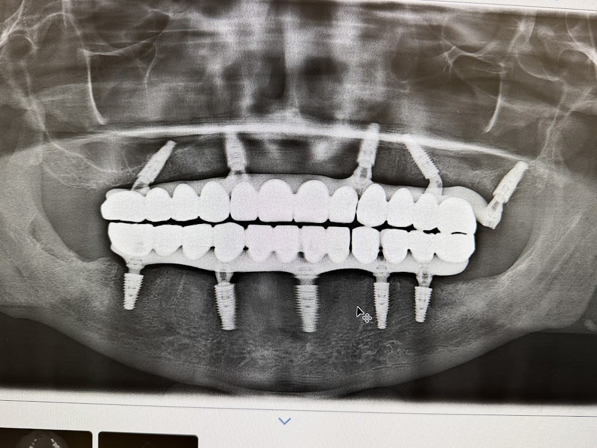 Signature Smiles Family & Implant Dentistry photo 5