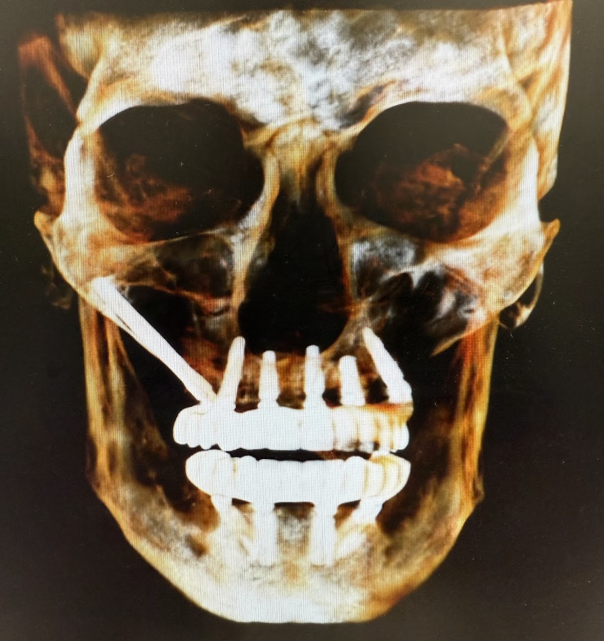 Signature Smiles Family & Implant Dentistry photo 6
