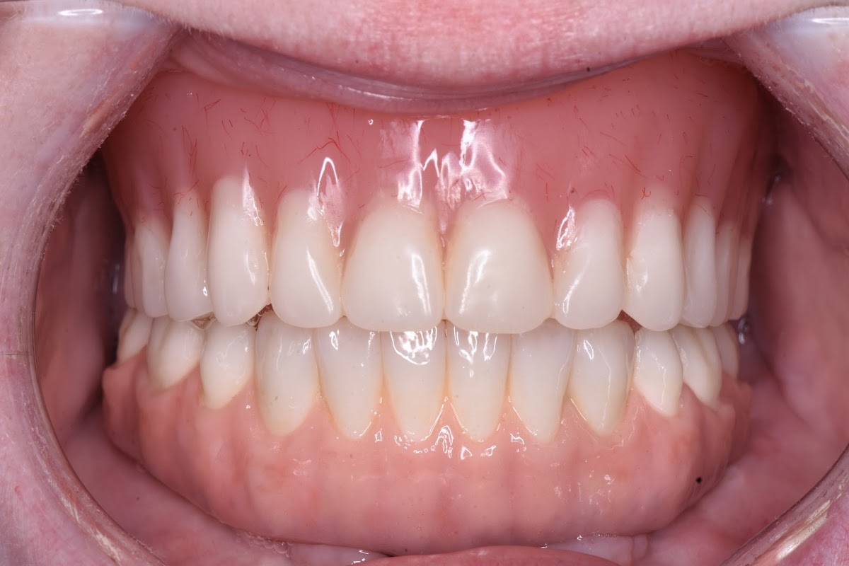 Ctx Oral Surgery & Dental Implants (Georgetown) photo 2