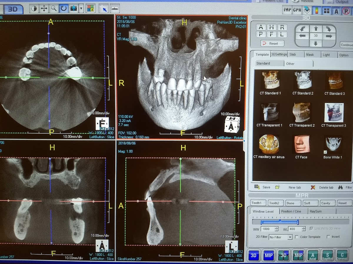 Amazing Smiles Dental Implant Center photo 6