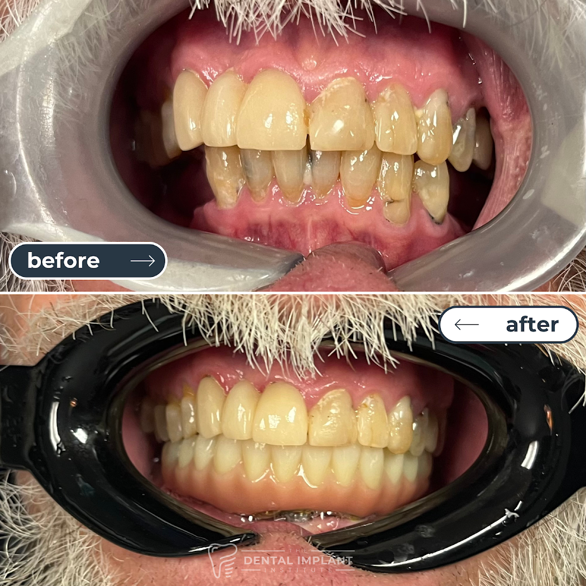 Dental Implant Institute photo 1