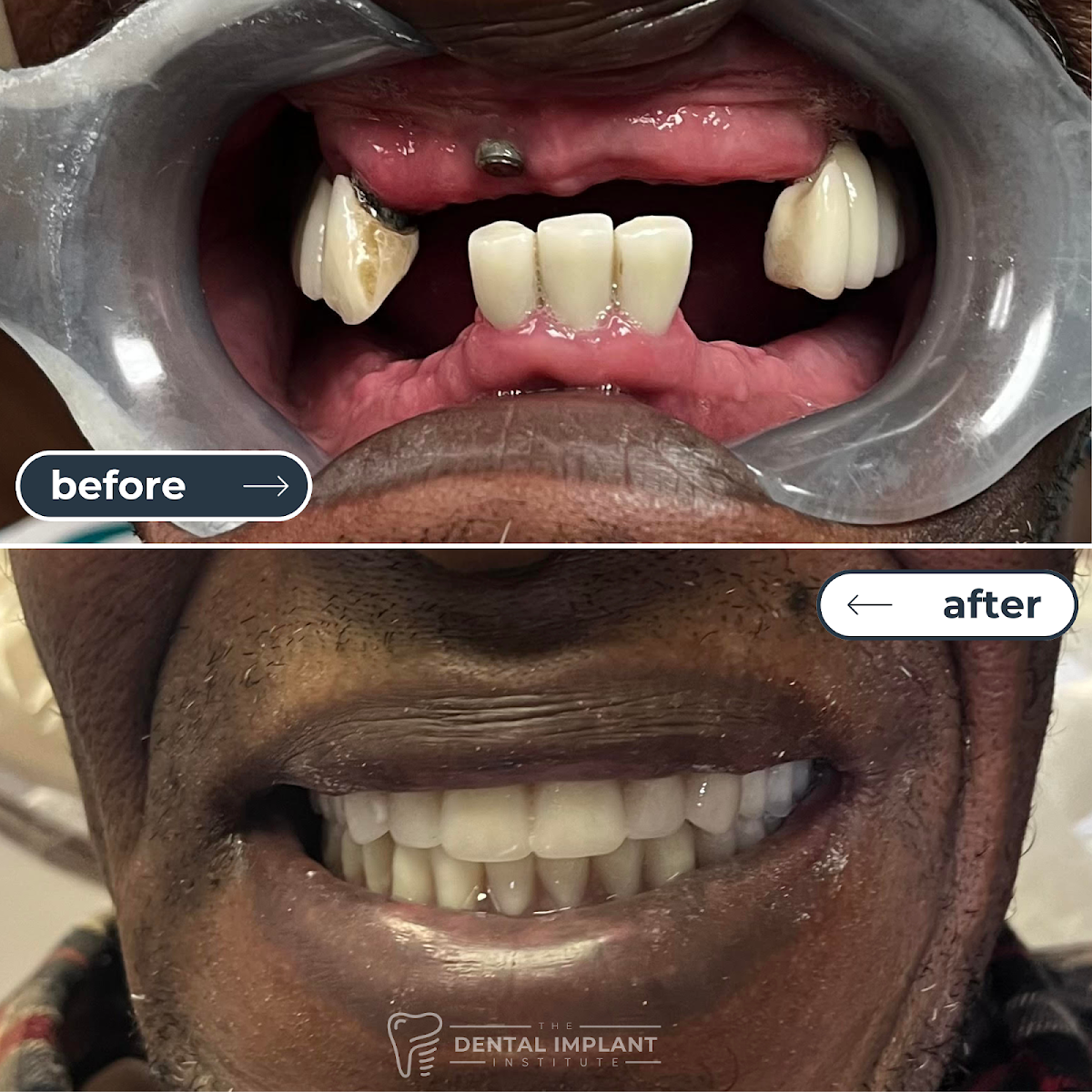 Dental Implant Institute photo 2