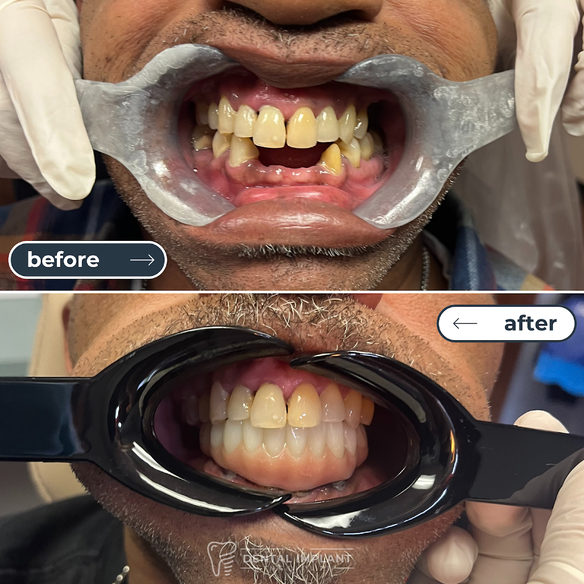 Dental Implant Institute photo 3