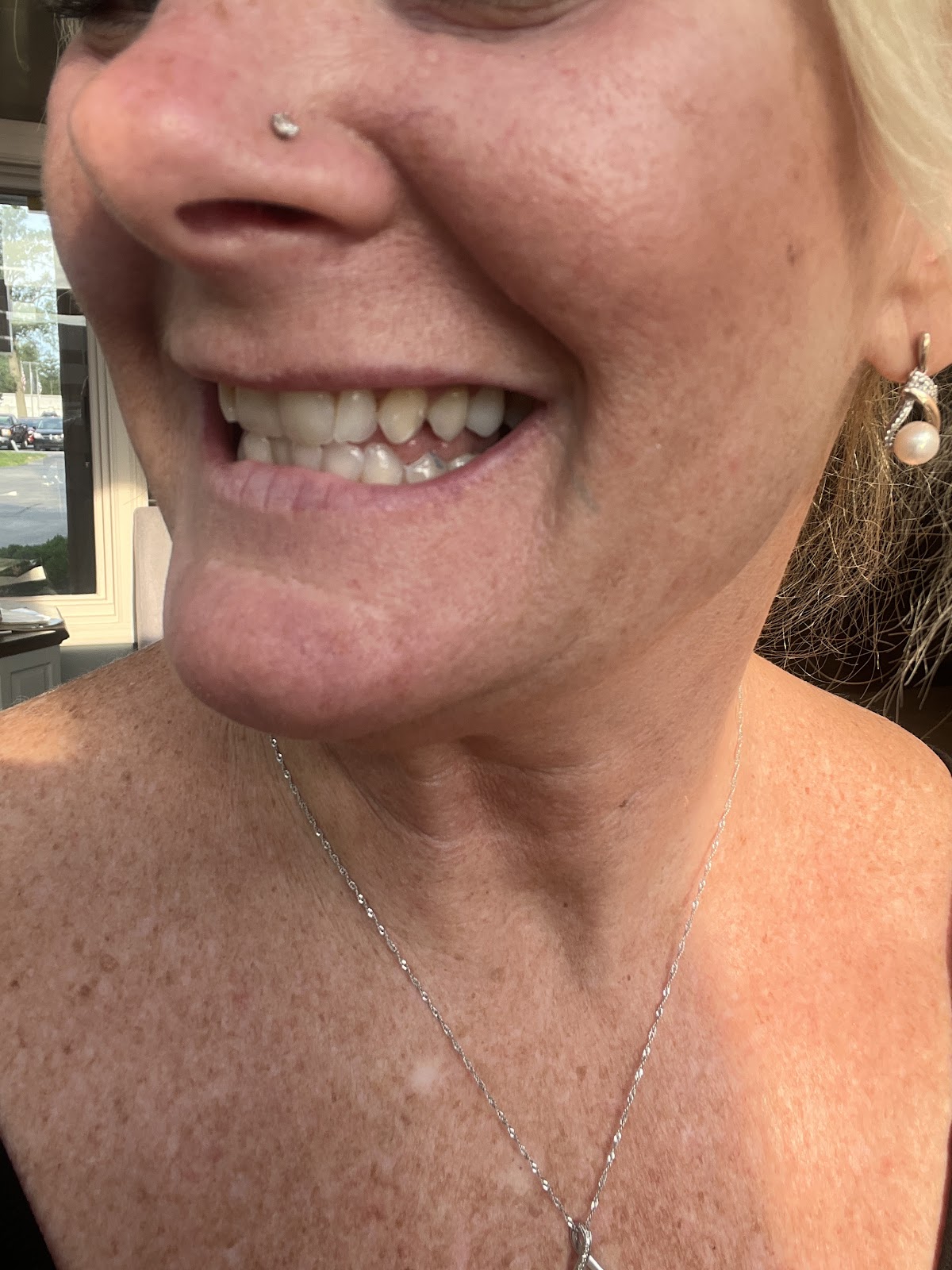 Dental Implant Institute photo 4