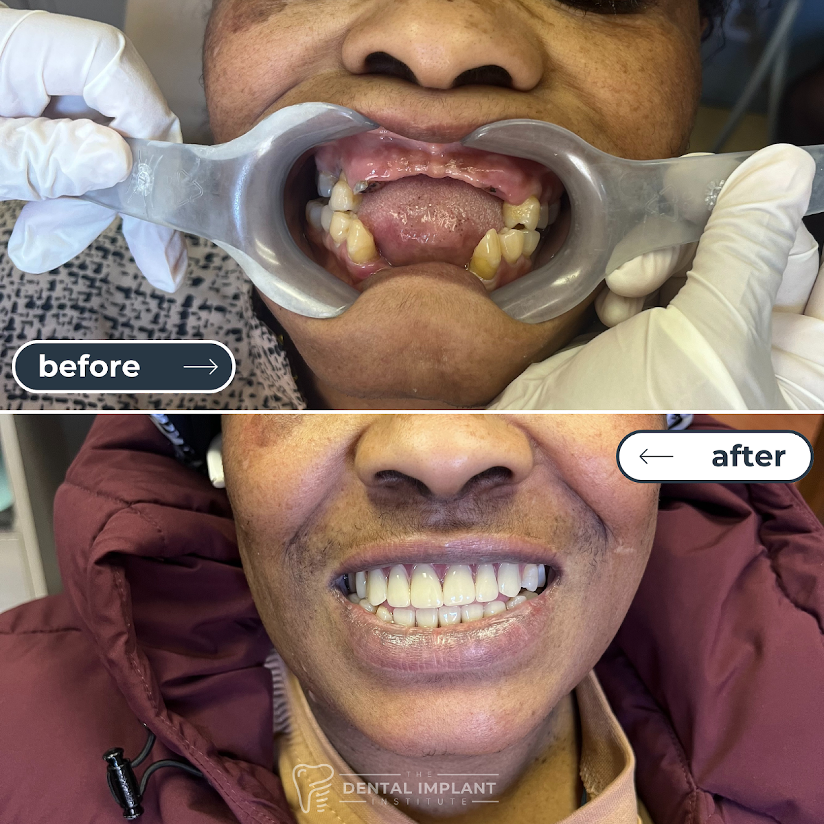 Dental Implant Institute photo 5